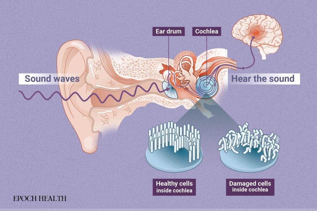 The cochlea sits behind the ear drum and turns sound waves into electrical signals that are then transmitted to the brain. (Illustration by The Epoch Times, Shutterstock)