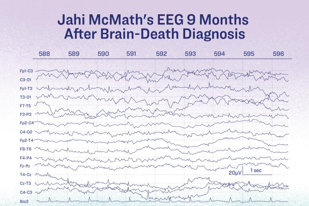 The EEG of Jahi McMath, who was declared brain dead, should have shown no activity. (Illustration by The Epoch Times)