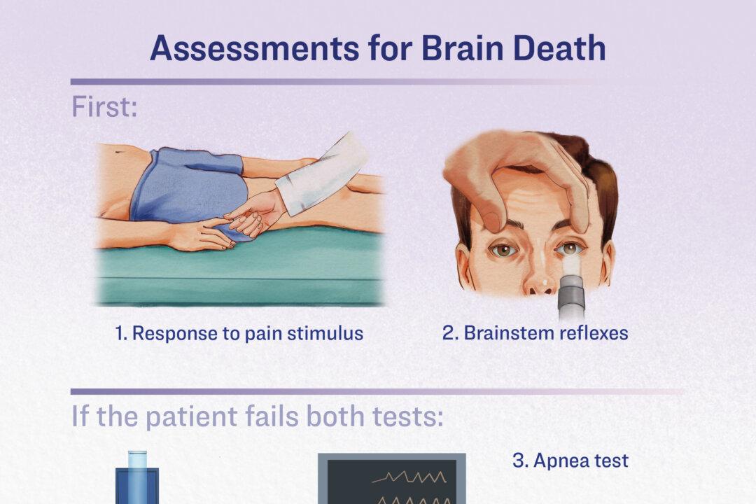 To assess brain death, doctors use a pain stimulus, check for brainstem reflexes, then conduct an apnea test if the patient fails both tests. (Illustration by The Epoch Times)
