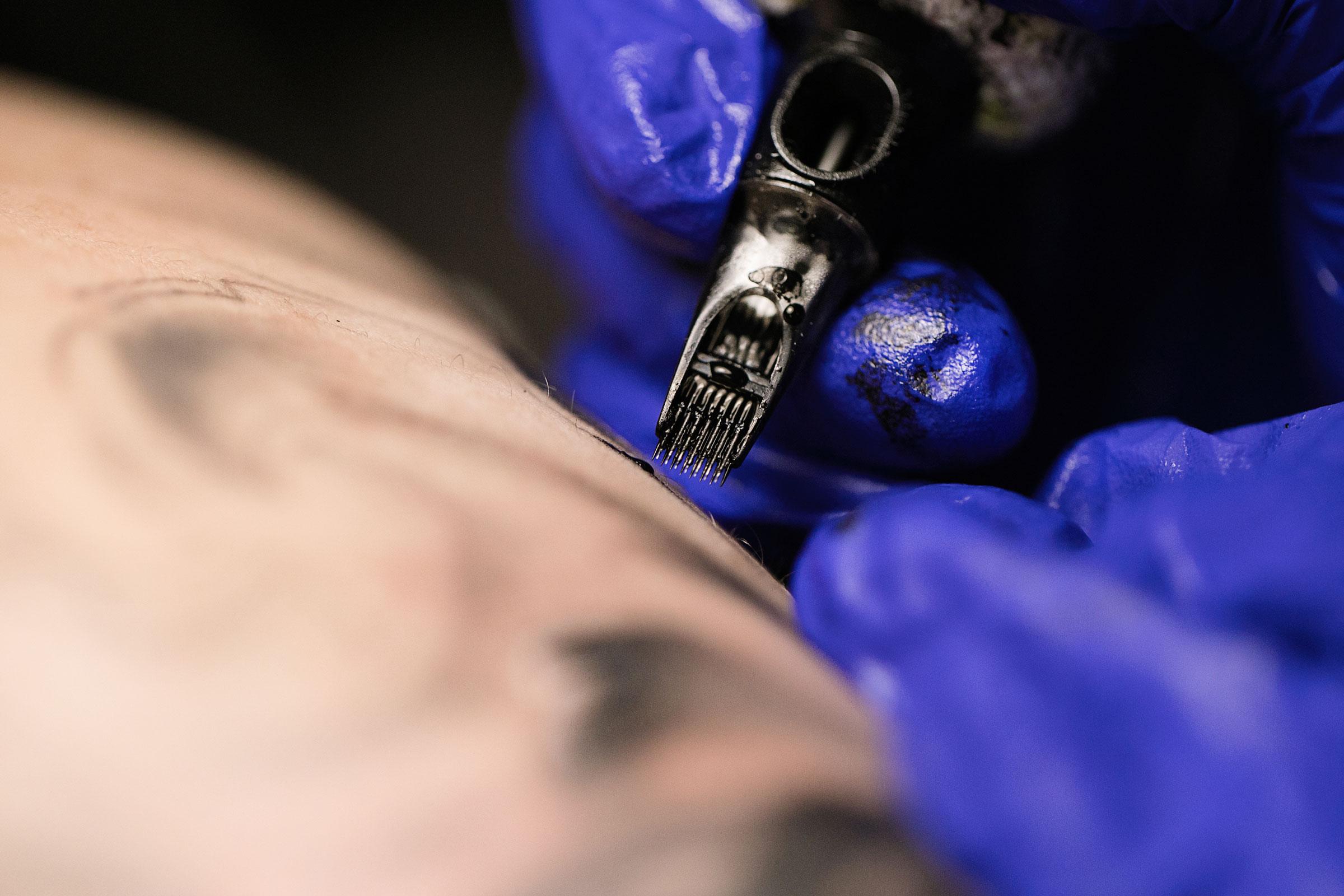 Tattoos Associated With Increased Lymphoma Risk, and Size Doesn’t Matter: Study