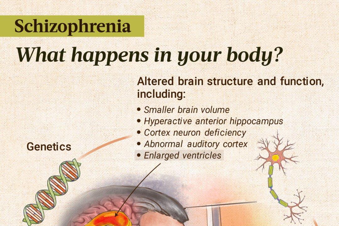 Schizophrenia is believed to be caused by a combination of factors, including prenatal conditions, altered structure or function in the brain, and genetics. (Illustration by The Epoch Times, Getty Images, Shutterstock)