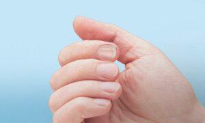 Fingernail Changes May Be Clues About Increased Cancer Risk