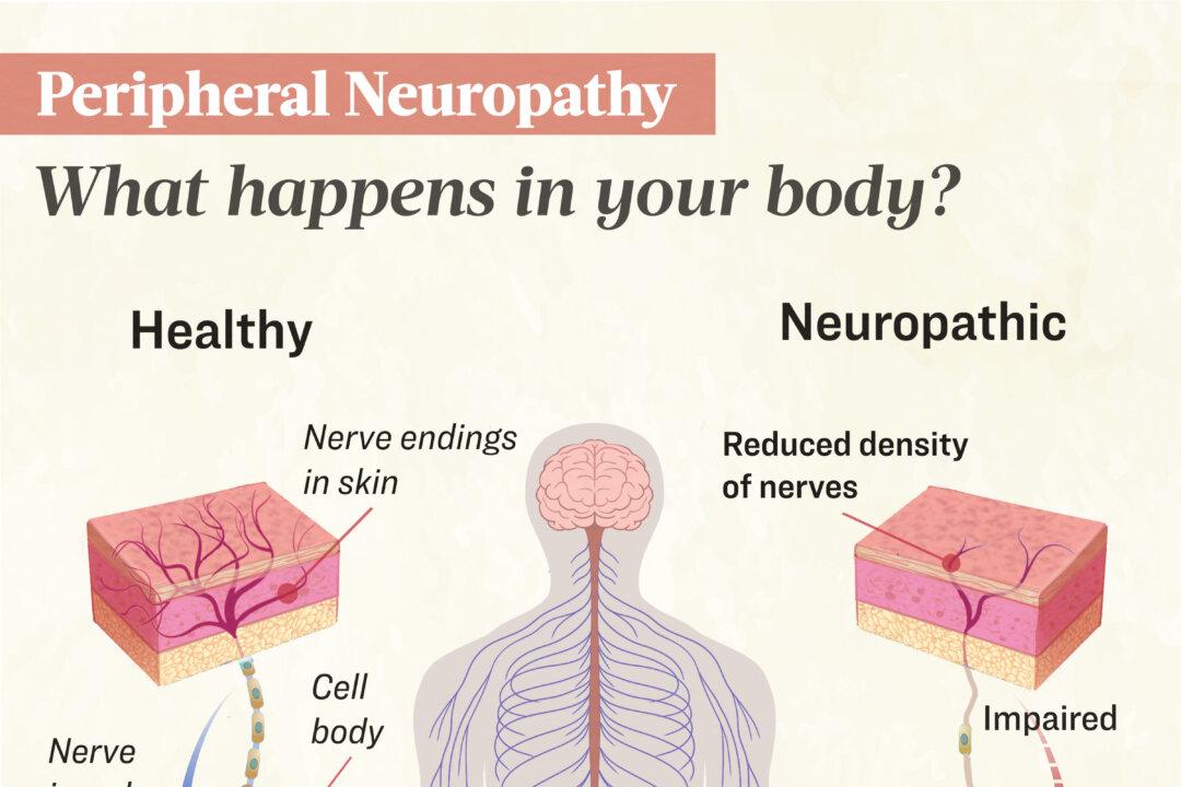 Peripheral neuropathy occurs when the peripheral nerves are damaged. Many factors can lead to the condition's development, including diabetes, hereditary disorders, infections, and toxic exposures. (Illustration by The Epoch Times, Shutterstock)