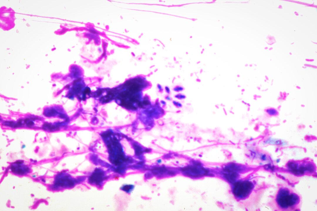 Clusters of T. gondii in bone marrow. (Cultura RM Exclusive/Michael J. Klein, M.D./Gettyimages)