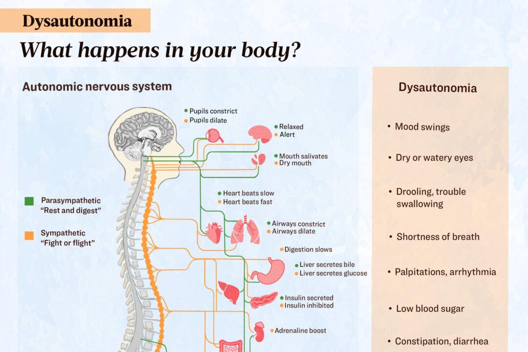 Dysautonomia occurs when something causes the autonomic nervous system, which oversees fight-or-flight and rest-and-digest responses, to malfunction. (Illustration by The Epoch Times, Shutterstock)