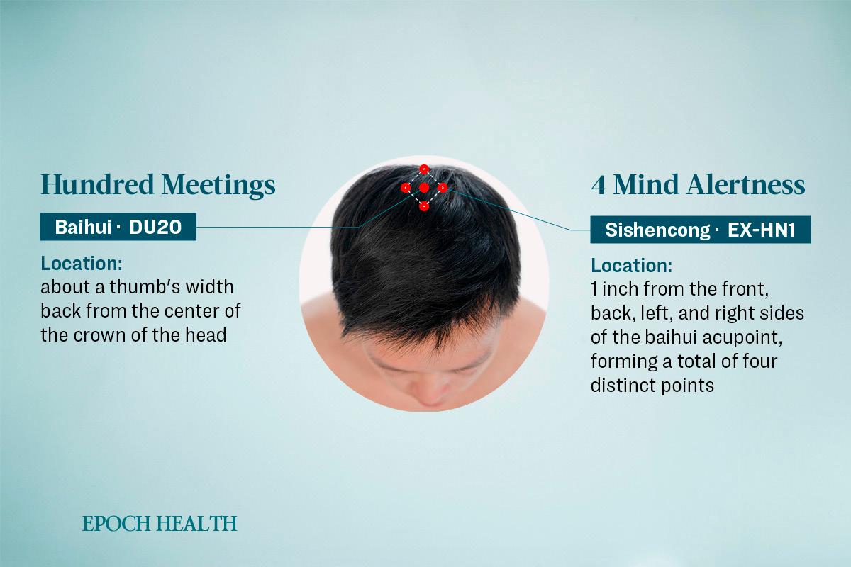 Location of the Baihui and Sishencong acupoints. (The Epoch Times)