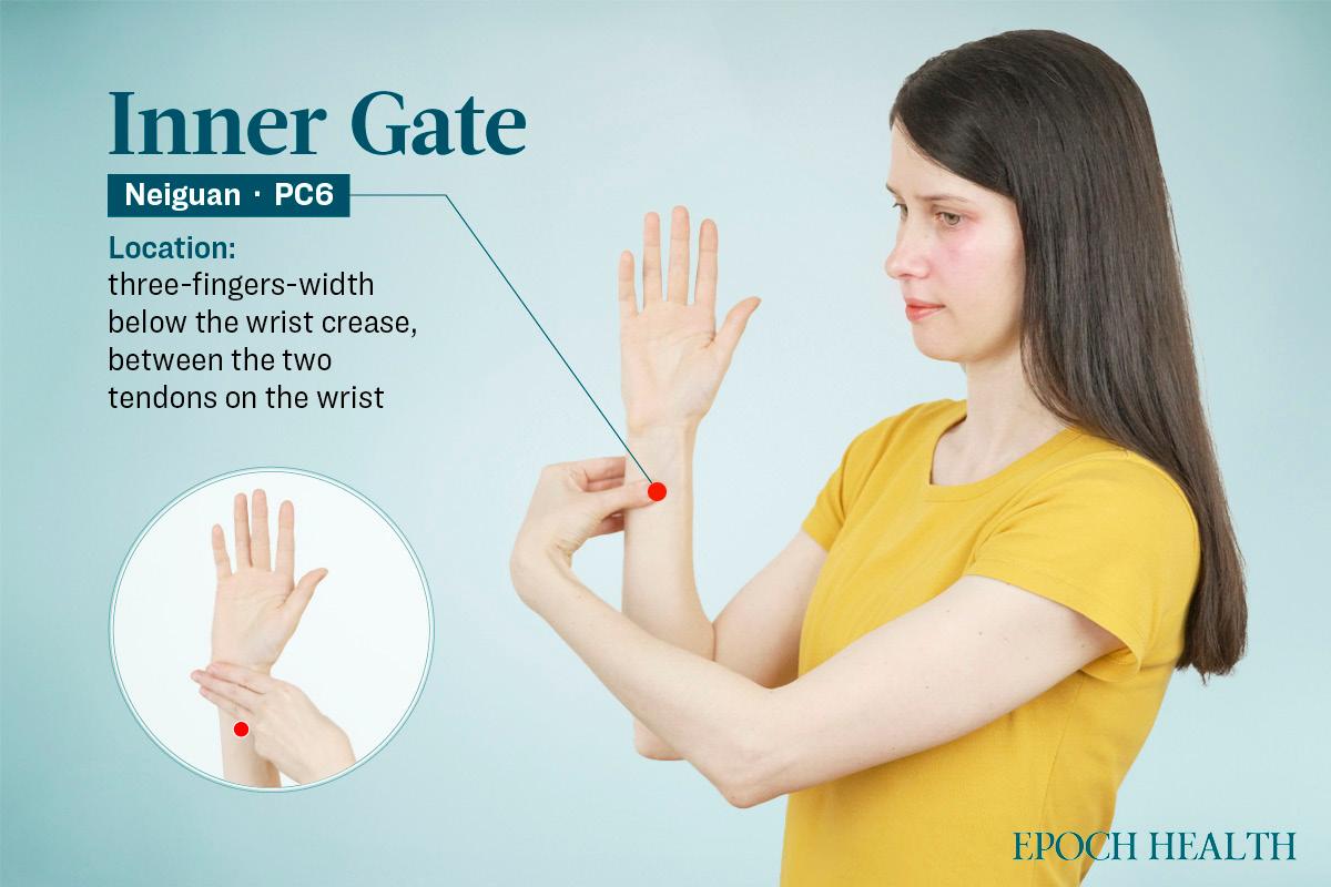 Location of the Neiguan acupoint. (The Epoch Times)