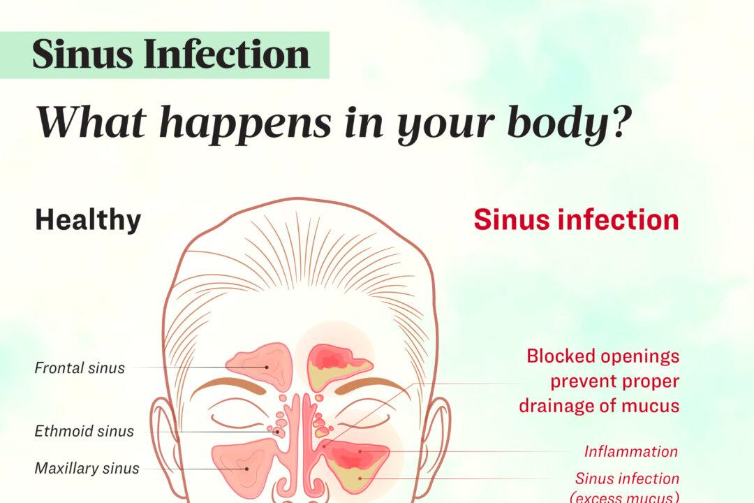 Sinus infections are usually caused by environmental factors, such as viruses, bacteria, or allergens. (Illustration by The Epoch Times, Shutterstock)