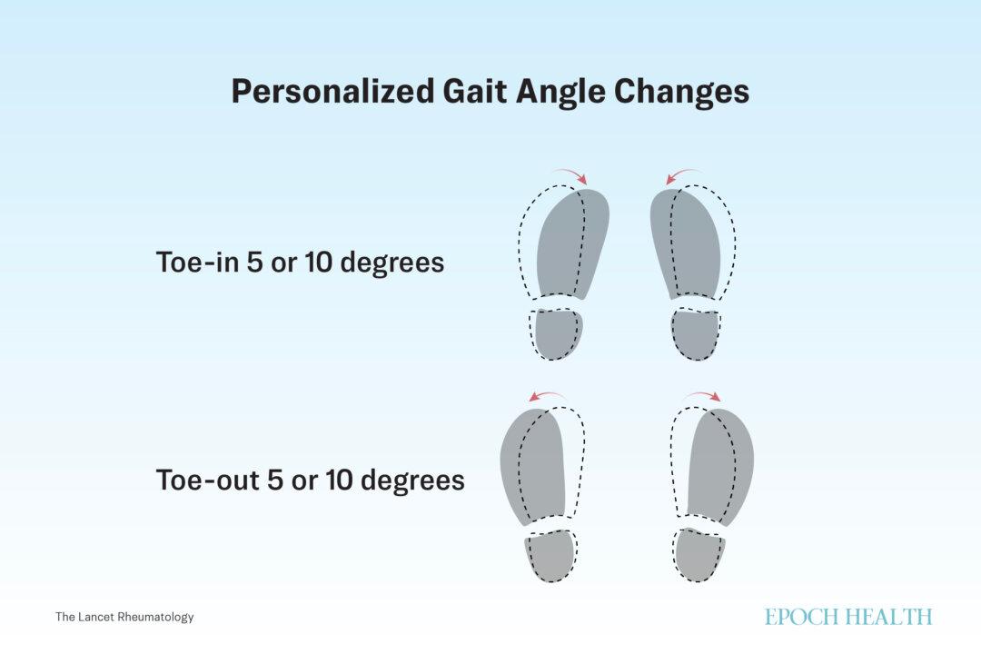 Researchers used motion capture and computer simulation to determine participants’ optimal foot angle for walking to reduce knee pain. Participants adjusted their walking angle by 5 to 10 degrees, either toeing in or toeing out. (The Epoch Times/Shutterstock)