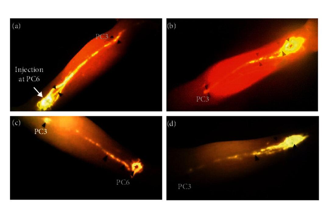 Fluorescent visualization of energy meridian. (Adapted from 'In Vivo Visualization of the Pericardium Meridian with Fluorescent Dyes,' Tongju Li et al., Evidence-Based Complementary and Alternative Medicine. Mar 29, 2021; doi: 10.1155/2021/5581227)