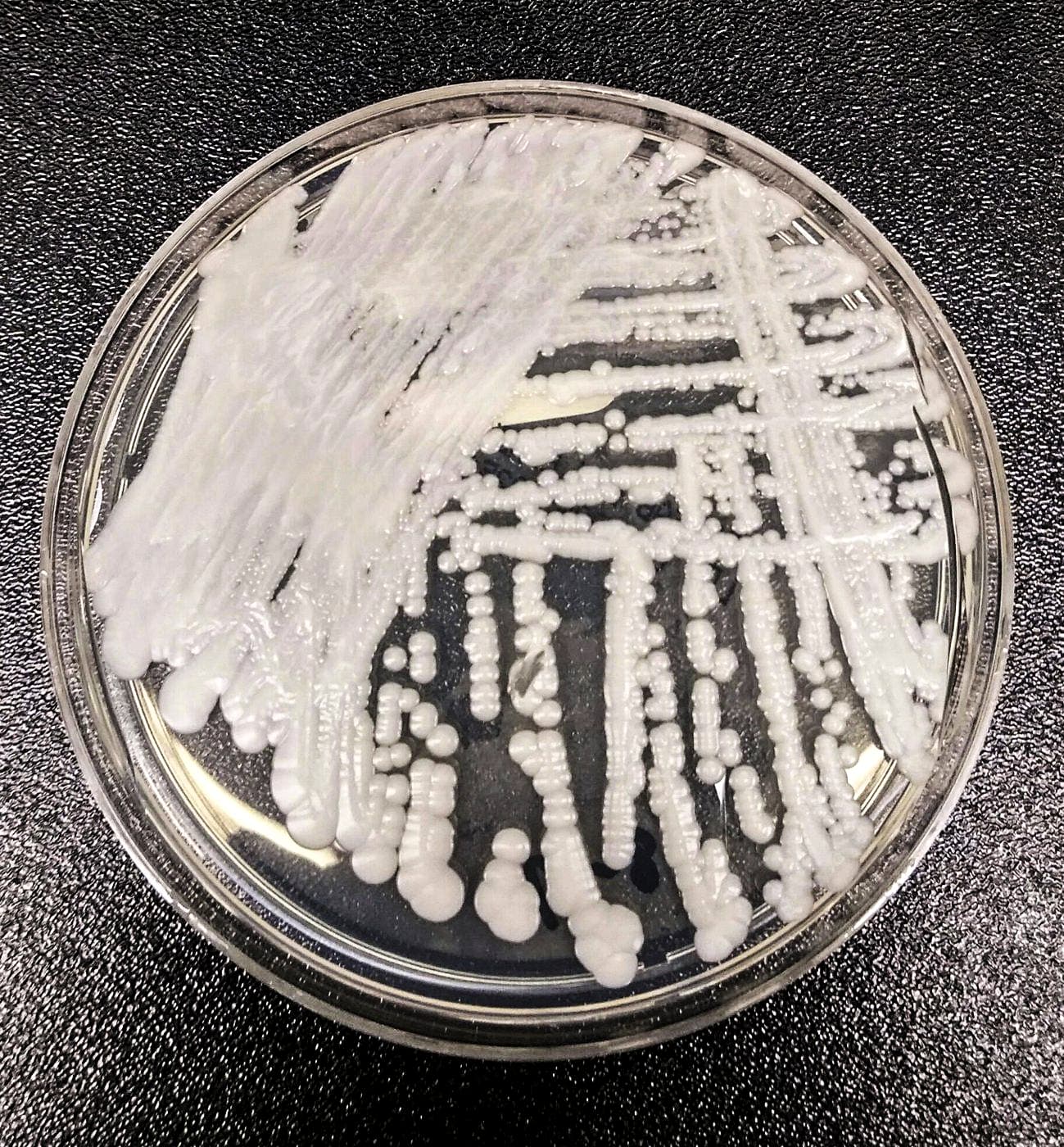 This undated photo made available by the Centers for Disease Control and Prevention shows a strain of Candida auris cultured in a petri dish at a CDC laboratory. (The Canadian Press/Shawn Lockhart-CDC via AP)