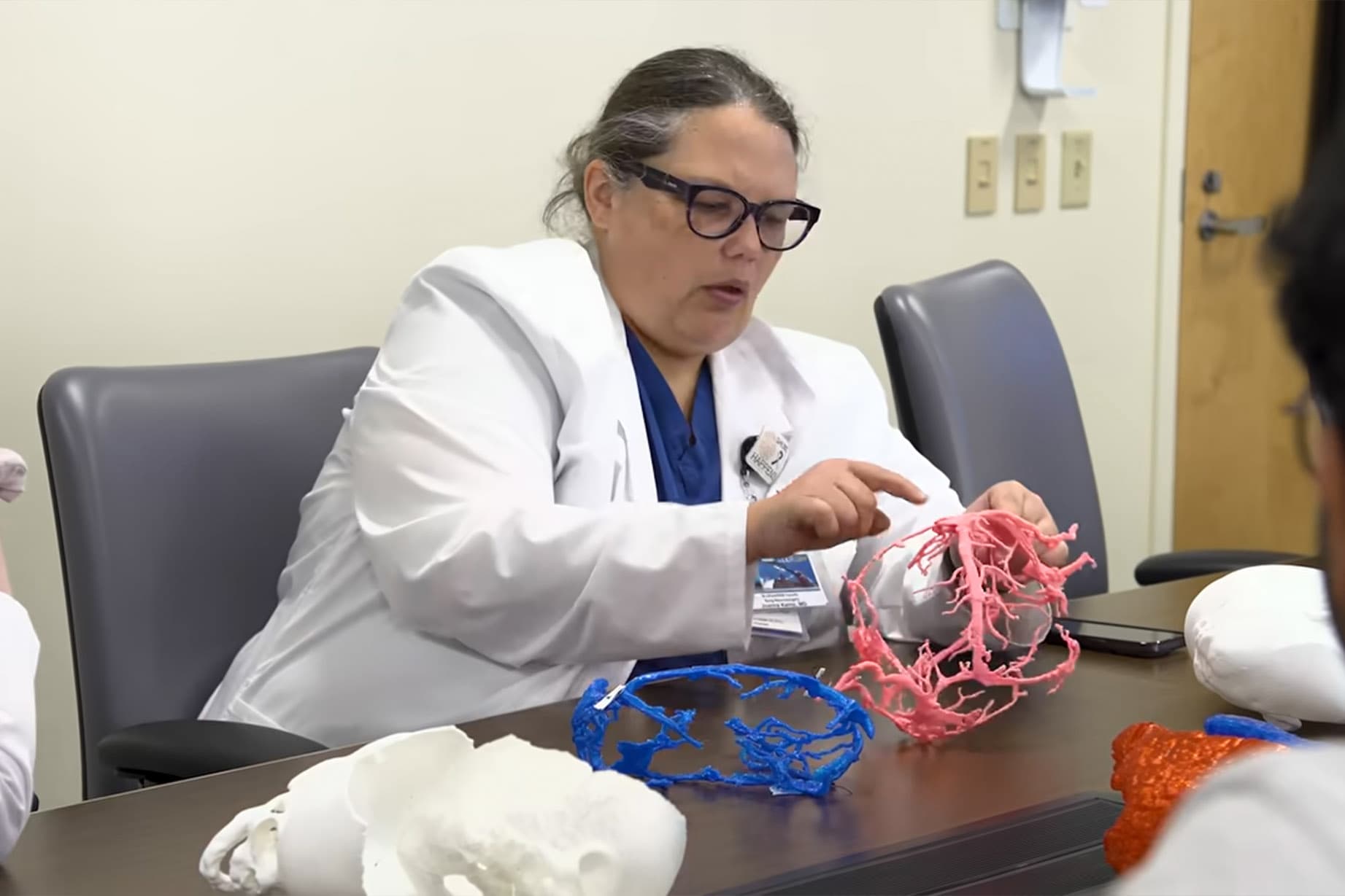 Dr. Joanna Kemp examines a high-fidelity 3D-printed replica of the twins’ interconnected venous system ahead of the milestone surgery. (SSM Health Cardinal Glennon Children's Hospital)