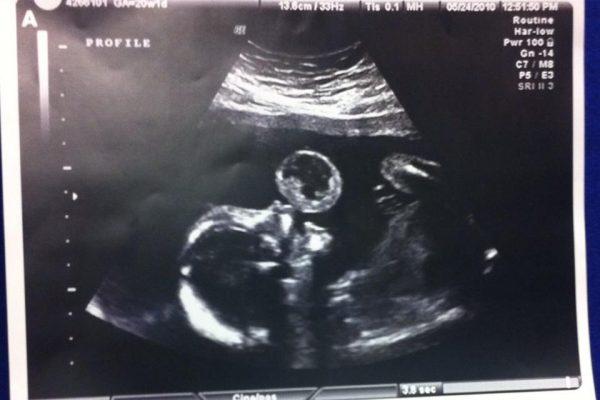 Photo courtesy of <a href="https://www.facebook.com/JacksonHealth/" target="_blank" rel="noopener">Jackson Health System</a>