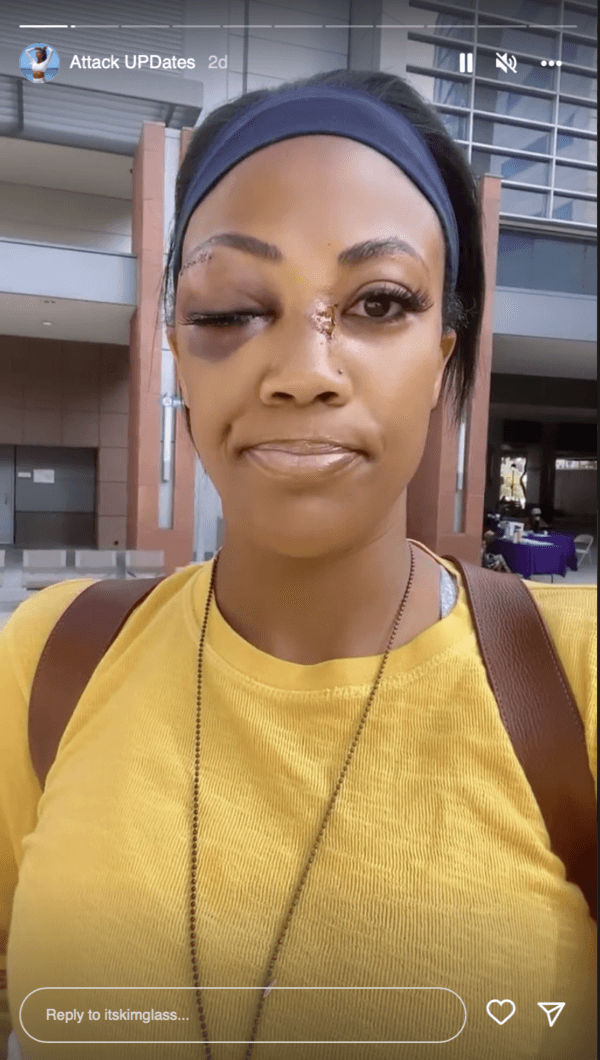 (Screenshot/itskimglass via Instagram)