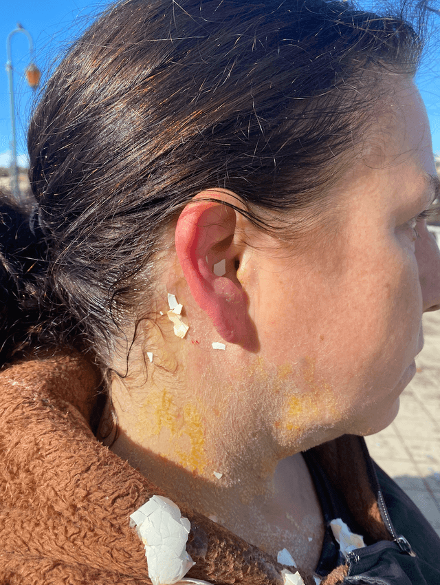Women protesting the possible transfer of convicted killer Dana Rivers—a biological man who identifies as female—to a women’s prison were attacked outside of the Alameda County Superior Courthouse in Oakland, Calif., on Dec. 5, 2022. (Courtesy of Women's Declaration International, U.S.A.)