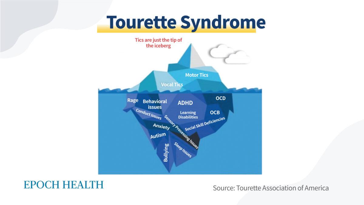 Tourette syndrome includes many symptoms we tend to overlook. (The Epoch Times)