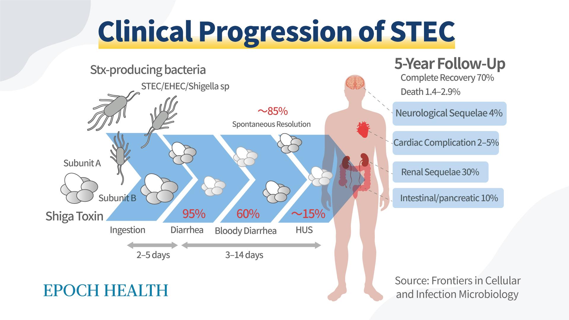 The clinical progression of STEC tends to resolve by itself, yet there are still a handful of tedious complications that follow. (The Epoch Times)