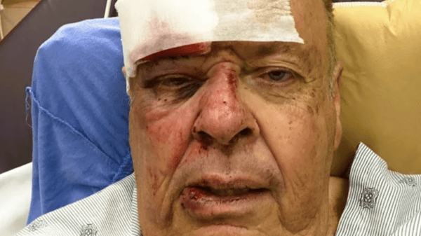 A Los Angeles Police Department volunteer identified only as Gary is seen in the hospital after being stung by bees. (Screenshot via GoFundMe)