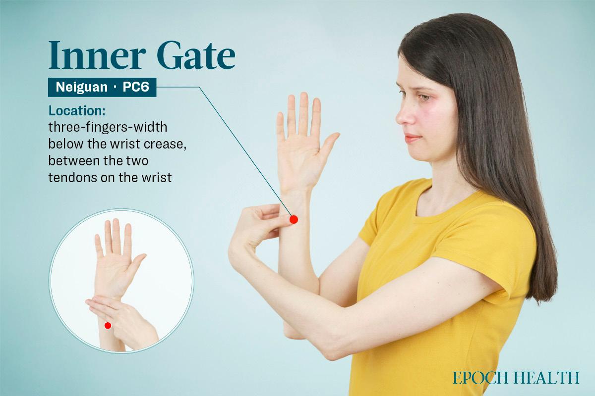 Location of the neiguan acupoint. (The Epoch Times)
