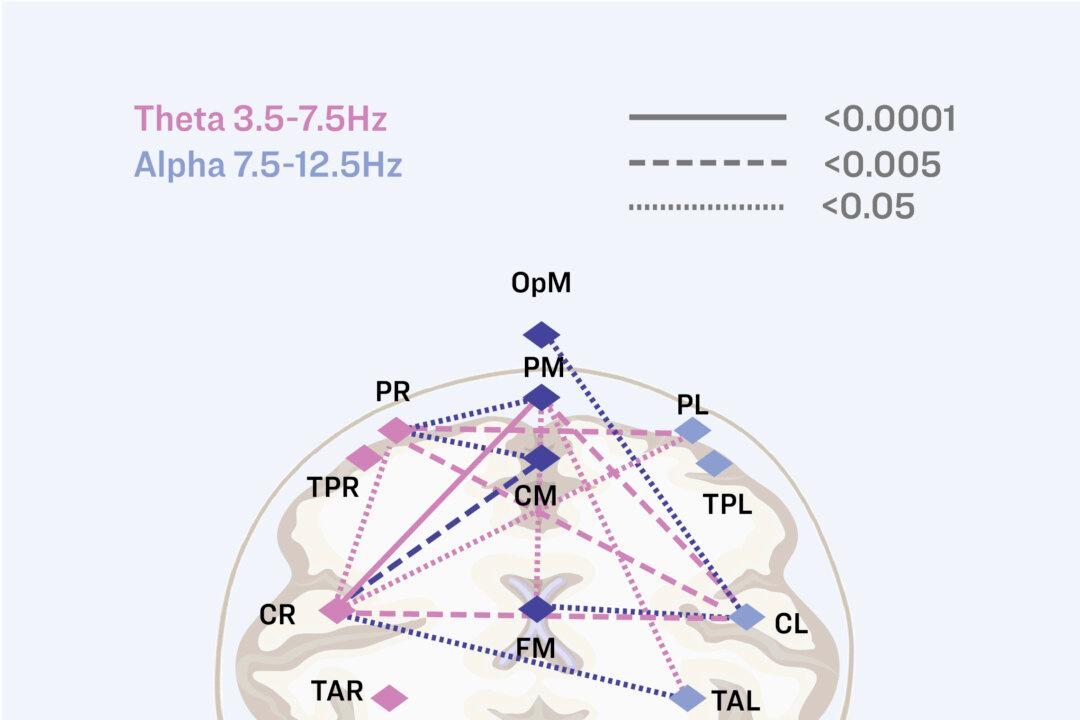 A brain model showing the widespread connections formed during handwriting. Pink lines show theta wave connections and blue lines show alpha wave connections. Solid lines represent the strongest connections, while dashed and dotted lines show progressively weaker (but still significant) connections. These extensive connection networks appear during handwriting but not during typing. (Illustration by The Epoch Times, Shutterstock, Courtesy of Norwegian University of Science and Technology)
