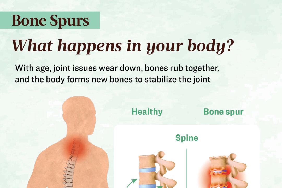 As joints wear down with age, the body may form bone spurs to stabilize the area—often leading to pain in the spine, knees, or heels. (The Epoch Times/Shutterstock)