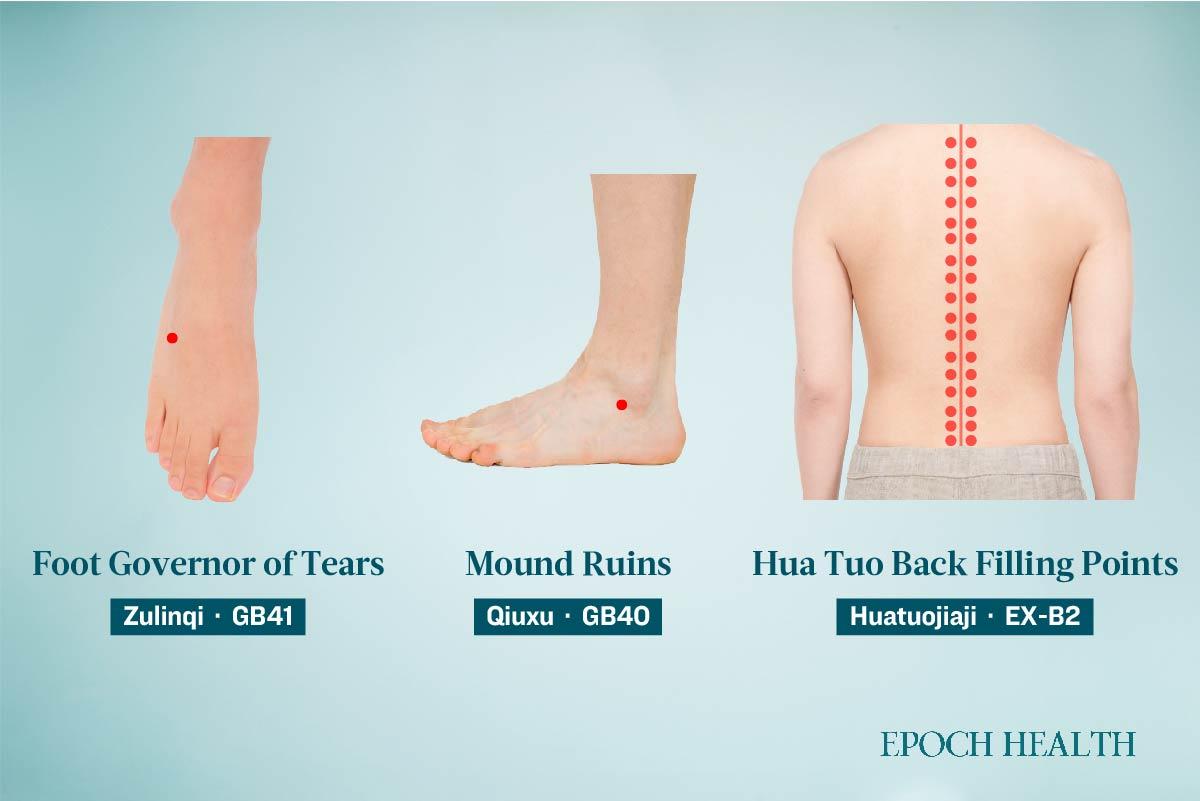 Location of the Zulinqi, Qiuxu, and Huatuojiaji acupoints. (The Epoch Times)