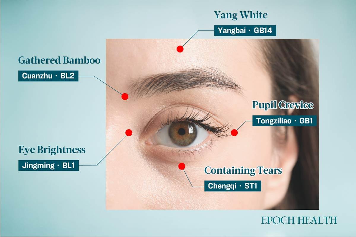 Key acupoints for reducing nasolabial folds. (The Epoch Times)