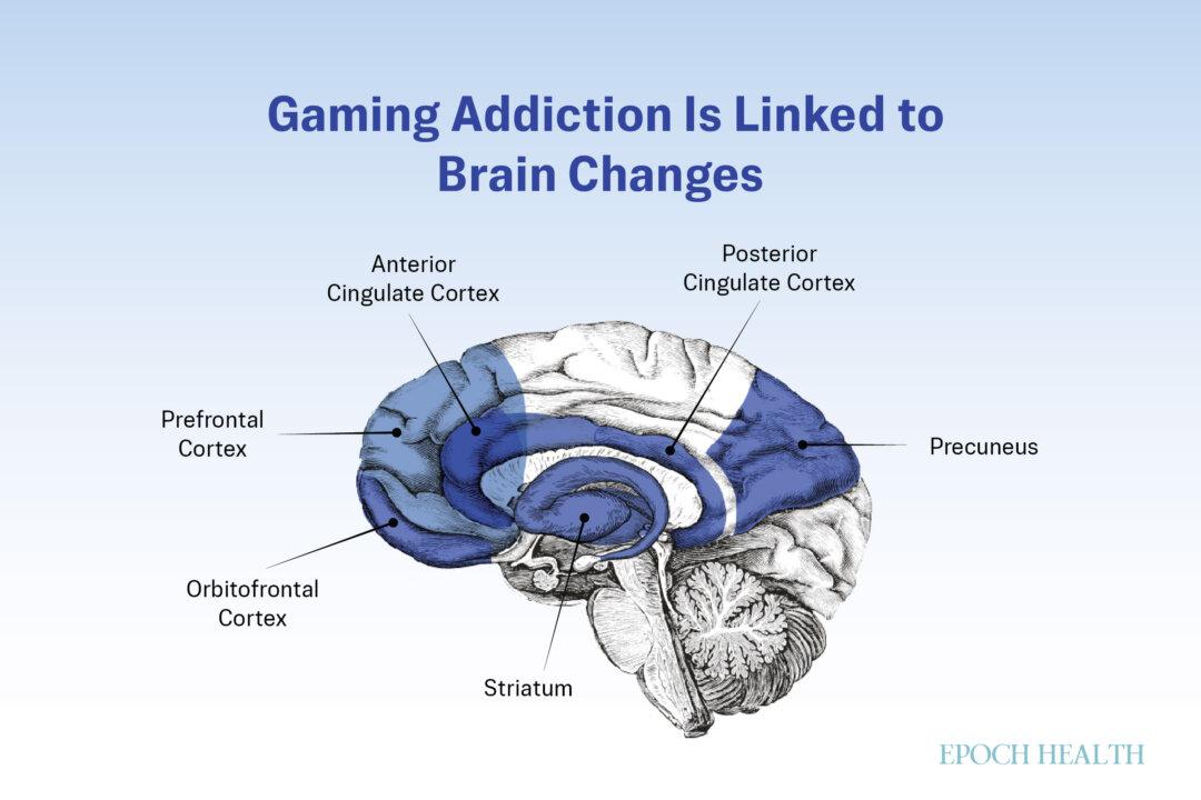 Gaming can affect many areas of our brains that are linked to addiction. (The Epoch Times)
