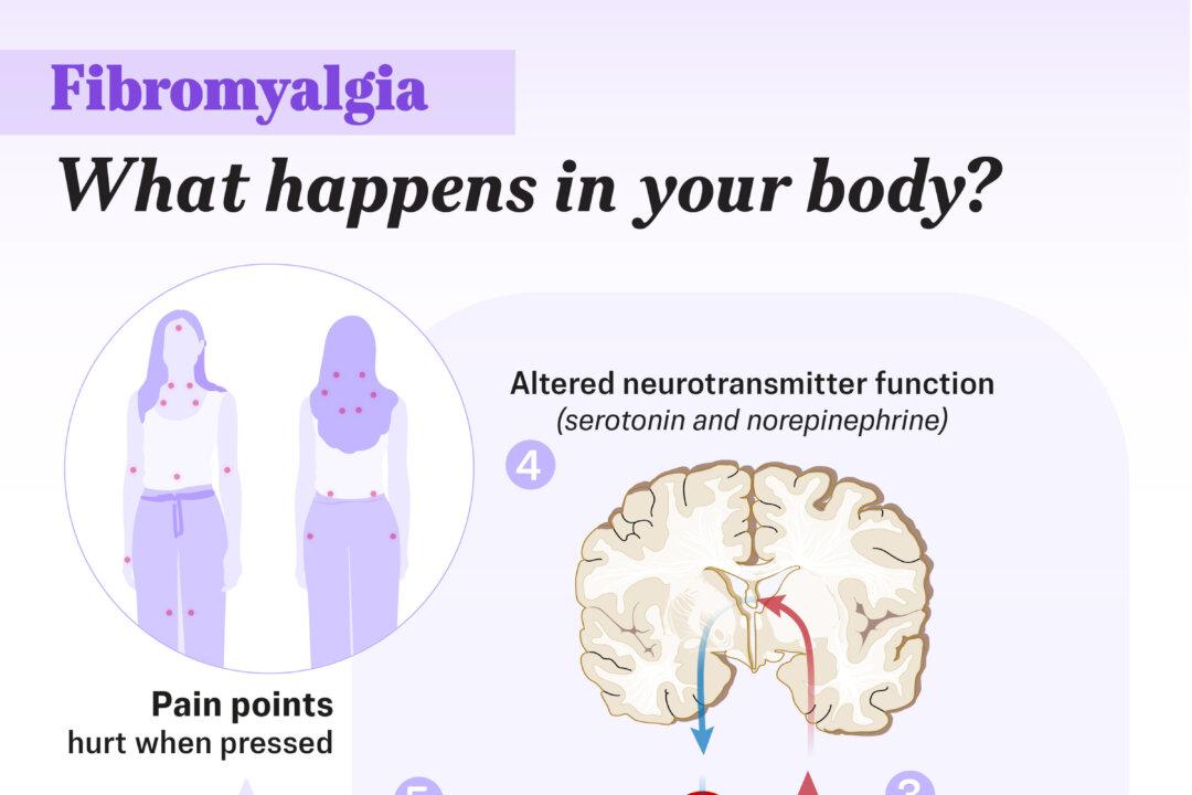 Fibromyalgia affects how the nervous system processes pain, causing signals to become amplified and leading to widespread pain, sensitivity, and fatigue. Illustration by The Epoch Times, Shutterstock