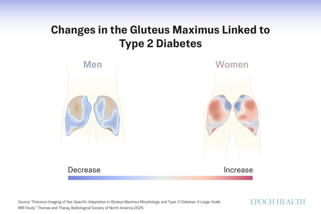 (Illustration by The Epoch Times)