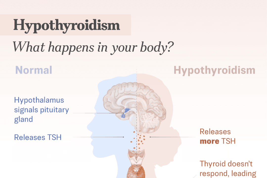 (Illustration by The Epochtimes, Shutterstock)