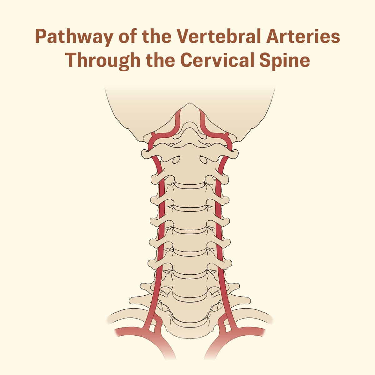 Pathway of the vertebral arteries through the cervical spine. (The Epoch Times)
