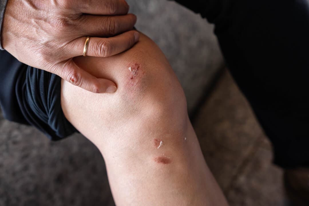 Xin Qin, a Falun Gong practitioner, displays her injuries a day after she was allegedly attacked by Chinese Communist Party supporters during a human rights demonstration in Washington on Sept. 25, 2026. (Samira Bouaou/The Epoch Times)